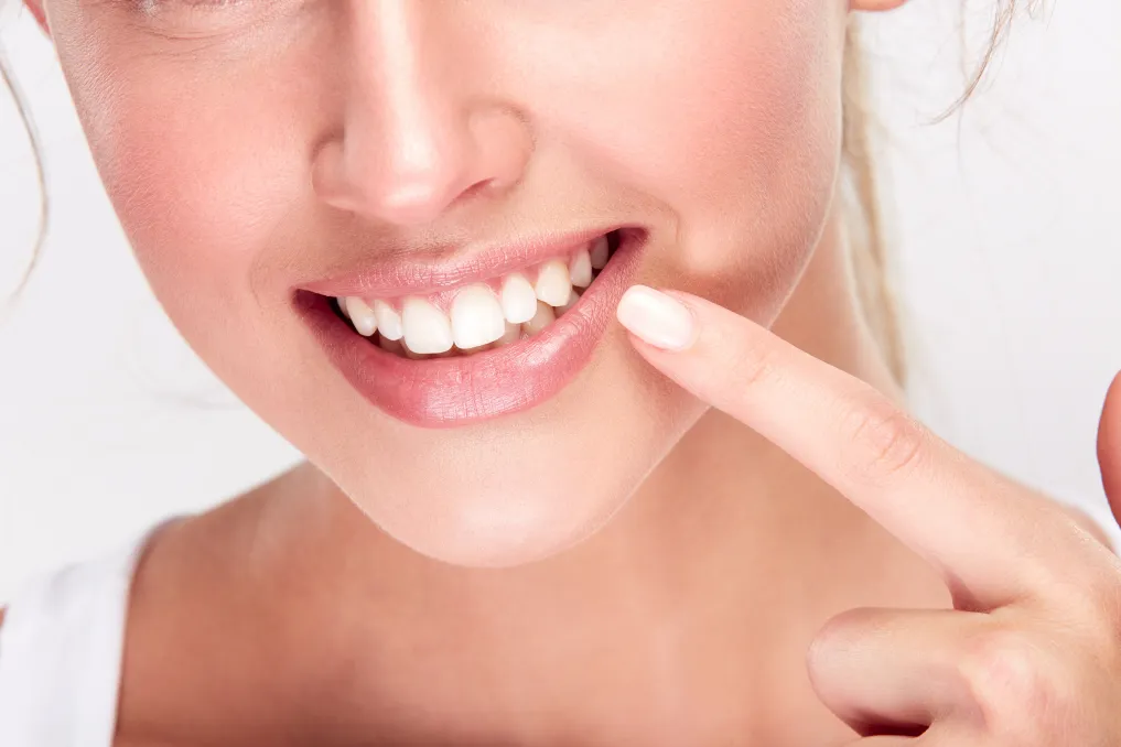 Dental Implant Restorations